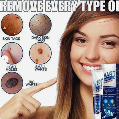 Instant Warts Removal Cream