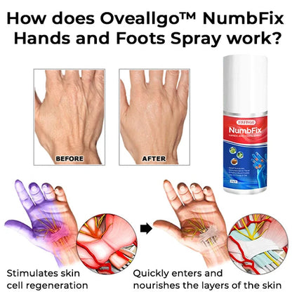 Oveallgo™ NumbFix Hands and Foots Spray (Buy 1 Get 1 Free)