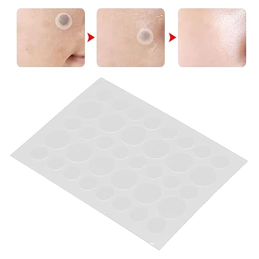 Face Acne Pimple Patch - Pack of 36