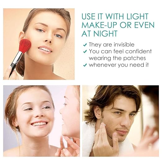 Face Acne Pimple Patch - Pack of 36