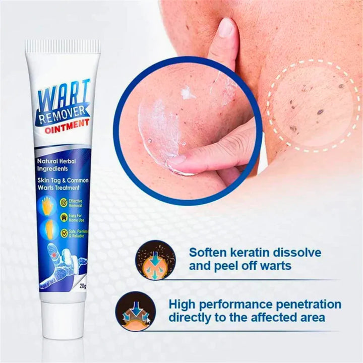 Instant Warts Removal Cream