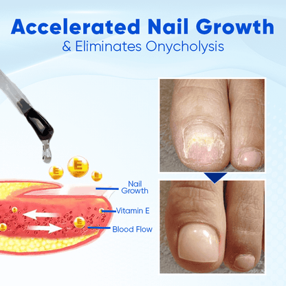 OnyxoGurad Nail Growth & Repair Serum