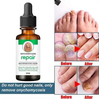 All In One Nail Serum 🔥 All Doctors 1st Choice 🔥(Buy 1 Get 1 Free)