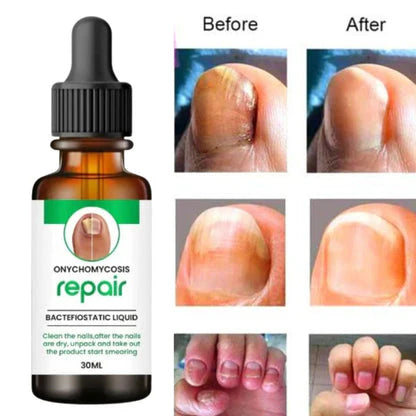 All In One Nail Serum 🔥 All Doctors 1st Choice 🔥(Buy 1 Get 1 Free)